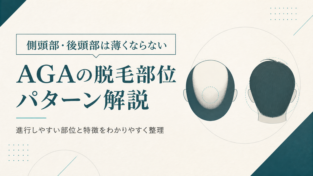 側頭部・後頭部は薄くならない｜AGAの脱毛部位パターン解説