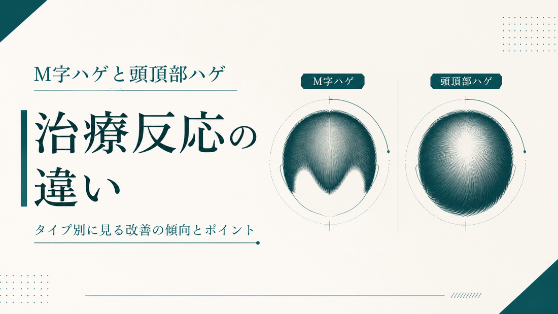 M字ハゲと頭頂部ハゲ 治療反応の違い