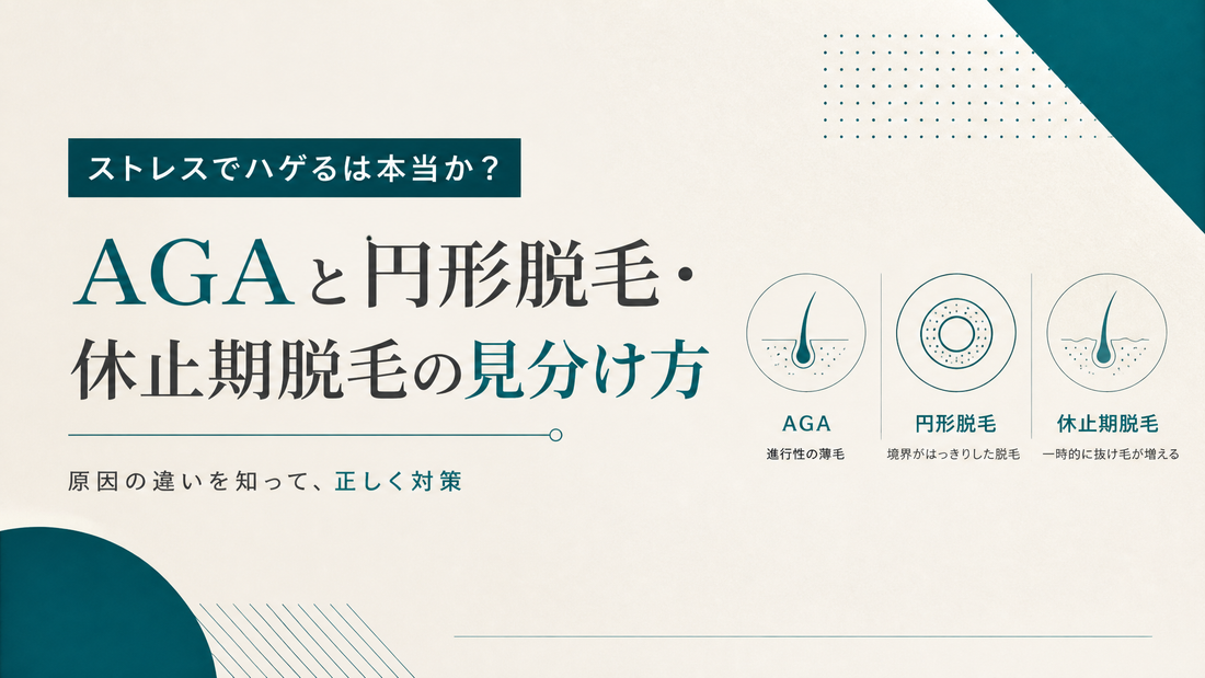 ストレスでハゲるは本当か｜AGAと円形脱毛・休止期脱毛の見分け方
