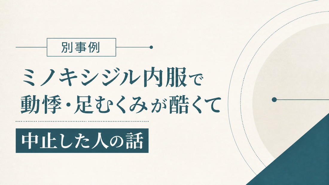ミノキシジル内服で動悸足むくみが酷くて中止した人の話 別事例